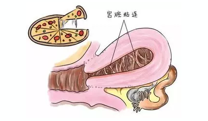 重慶送子鳥醫(yī)院