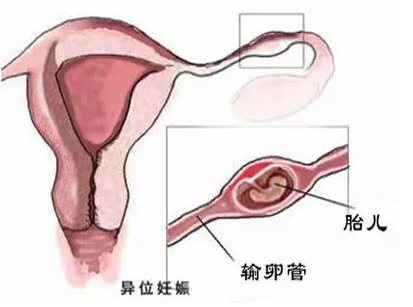 重慶送子鳥醫(yī)院