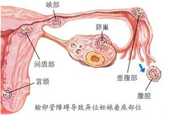 重慶送子鳥醫院